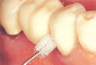 Prophylaxe für Erwachsene
